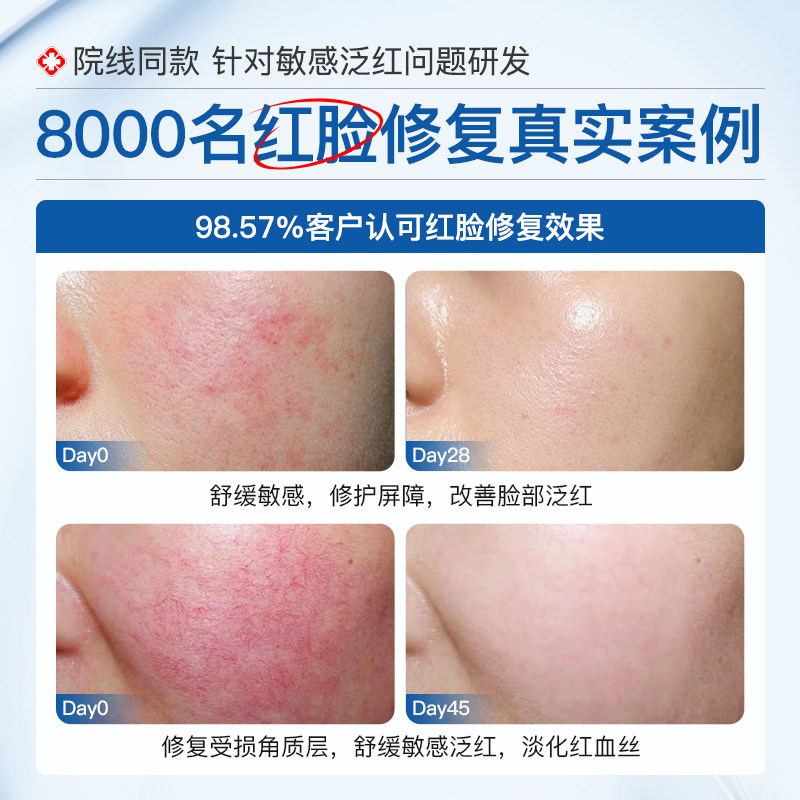 神经酰胺原液红血丝修复角质层薄增厚舒缓修护敏感肌护肤品精华