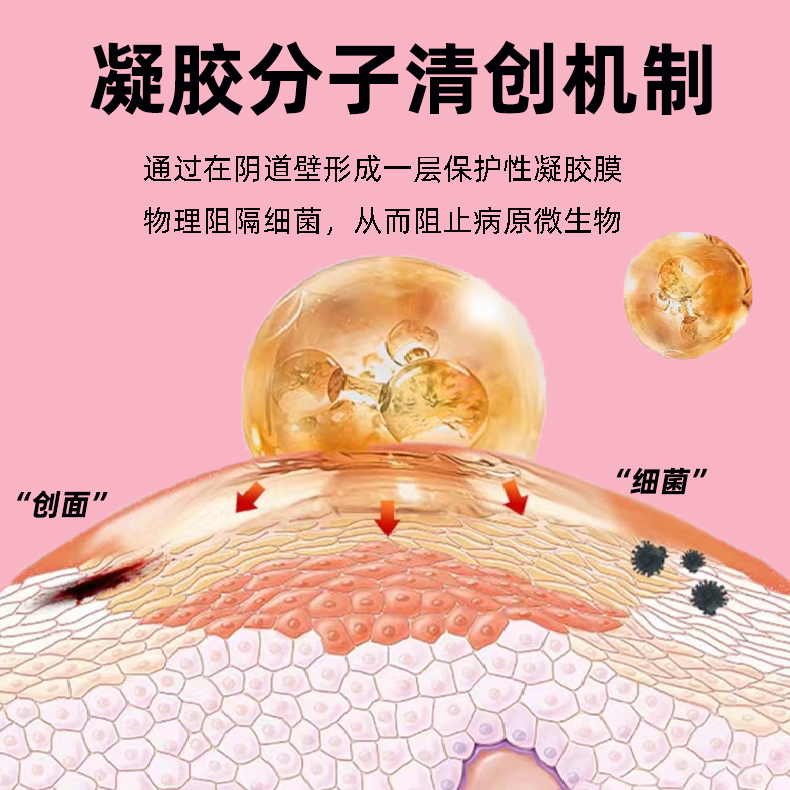 妇科凝胶医用械字号抑菌止痒宫阴宫颈糜创伤愈合日常护理药房同售 - 图0