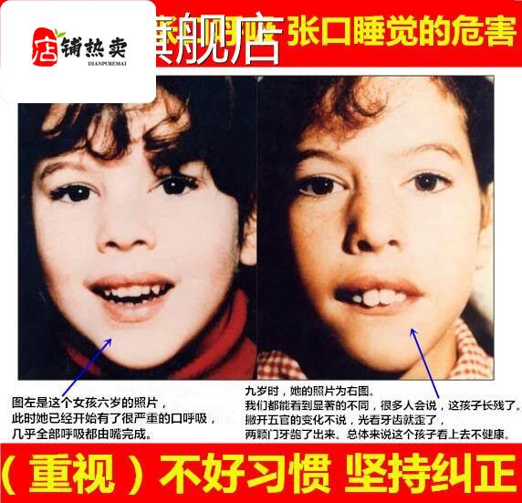 防龅牙幼儿呼吸帖婴儿嘴巴封口贴儿童封嘴贴睡眠宿舍鼻呼吸矫形 - 图1