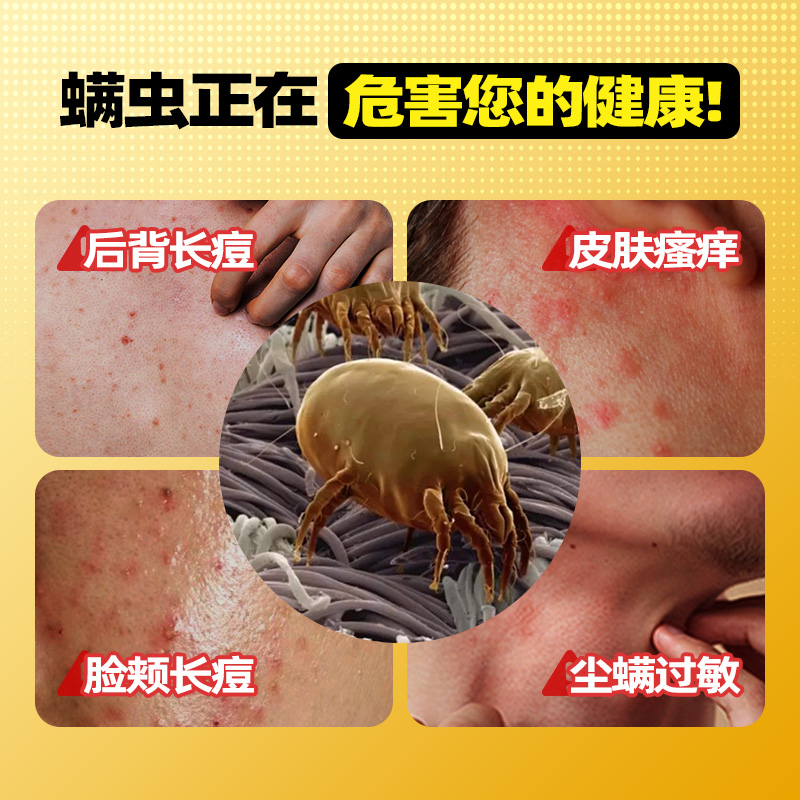 瑞娜川兰 西尔伯亚 亚西卡木 西圣瑞香圣亚南美香北优卡DABBS除螨 - 图0