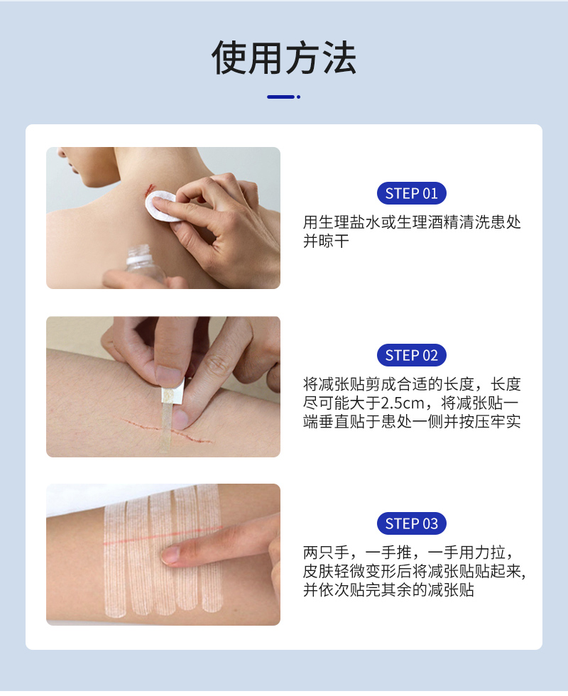 Omnistrip德免缝合器防止增生疤痕贴愈合伤口免减张贴胶带10包 - 图1