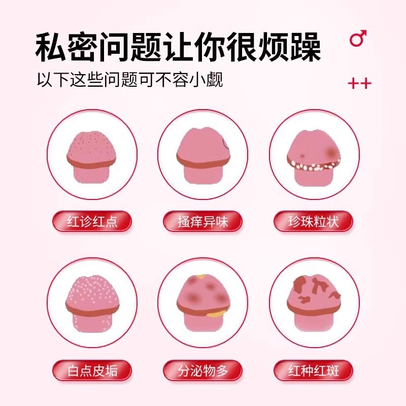 治疗龟头炎症包皮炎专用消炎药膏真菌感染男性喷剂霉菌性念珠菌用 - 图0