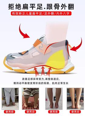 儿童内外八字扁平足矫正机能凉鞋
