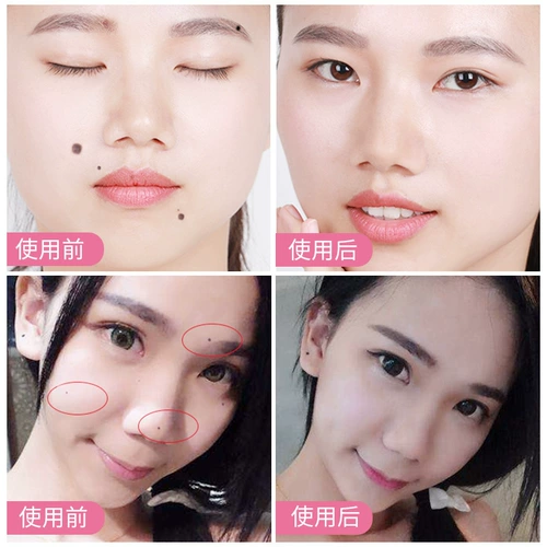 Осветляющее эфирное масло с розой в составе, меланин, очищающее молочко, осветление лица, удаление веснушек