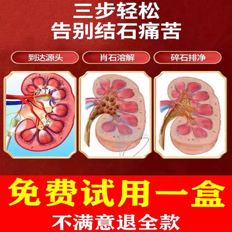 熊去氧胆酸片信谊胆囊息肉专用药胆囊单发多发胆息肉中药调理茶治 - 图1