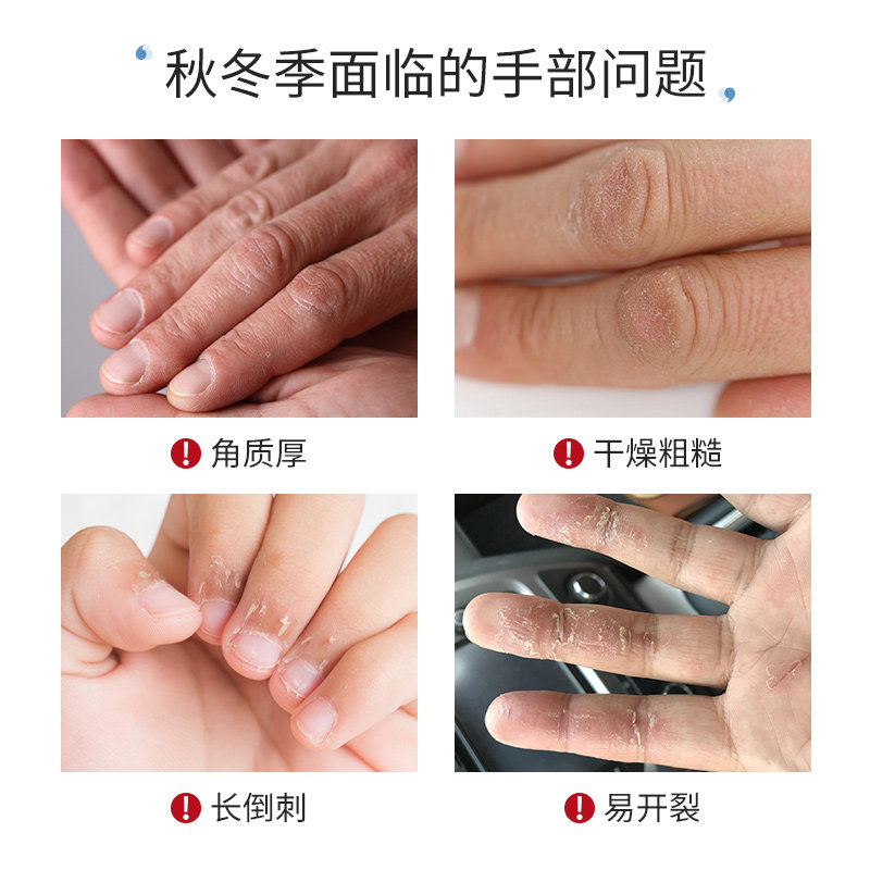 wxe凡士林男士滋润保湿不护手霜 wxe护手霜