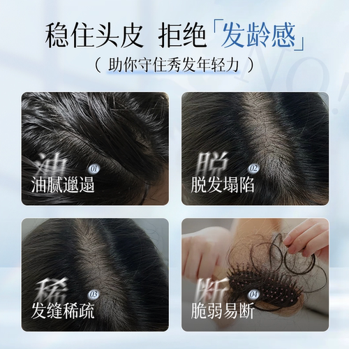 黛格娜洗发水防脱控油带代戴黛各个戈格哪拿呐那娜官方旗舰店正品 - 图0