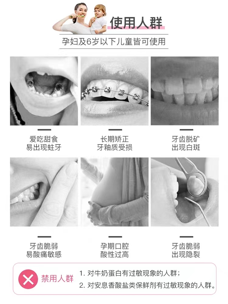 日本进口富士GC 护牙素含氟防蛀固齿40g儿童 - 图0