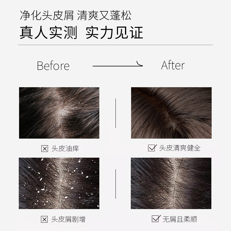 头道汤头皮清净液改善头皮护理凝露 头道汤洗发水