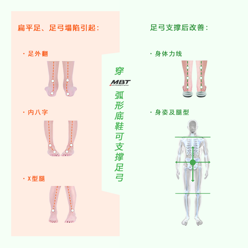 MBT弧形底男女厚底休闲通勤鞋 纠正走路姿势 足弓支撑 缓震BURANO - 图1