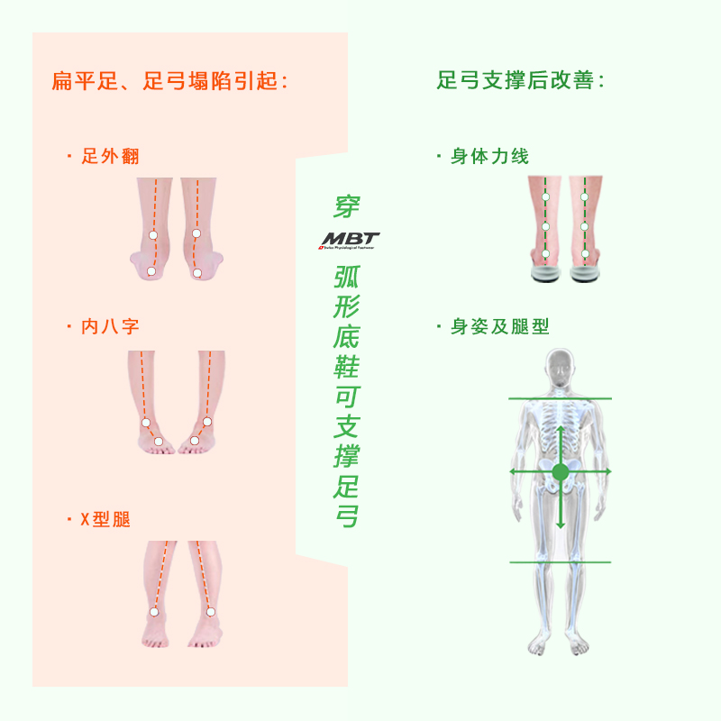 MBT弧形底男女厚底支撑健康跑鞋保护关节缓震马拉松 HURACAN3000 - 图2