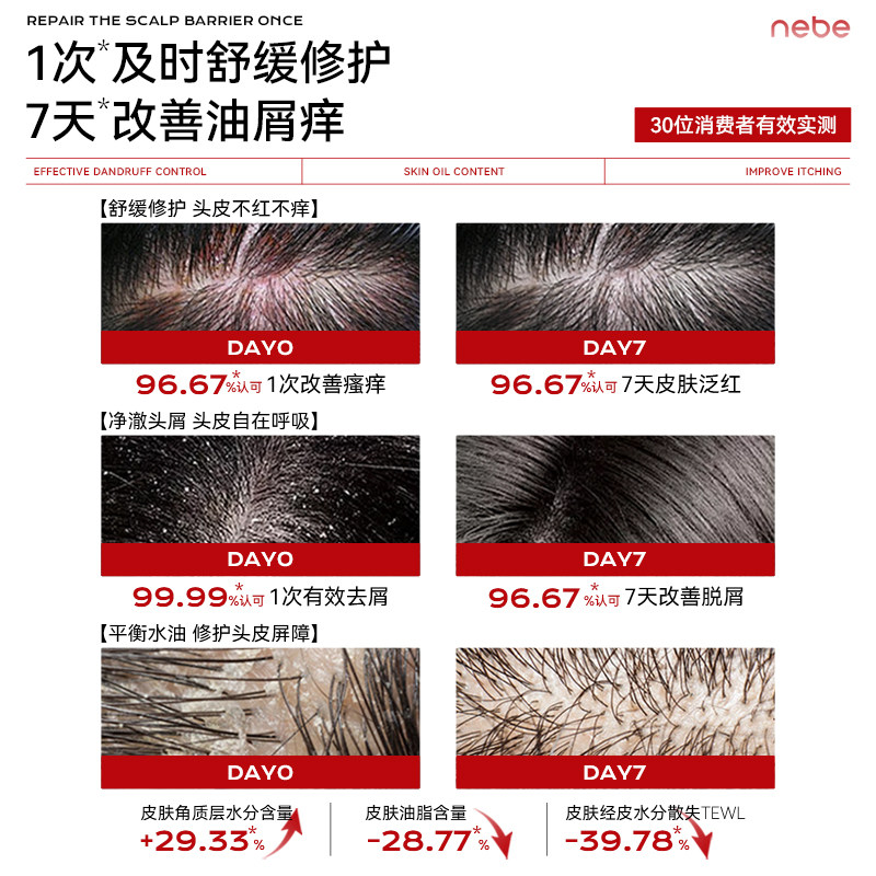 Nebe红没药醇头皮平衡洗发水去屑止痒洗头膏露液保湿补水控油蓬松,淘宝优惠券,粉丝福利购,淘宝优惠卷