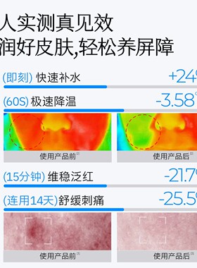 弥玥泉温泉补水喷雾爽肤水舒缓修护敏肌妆前囤货组合装喷雾1060ml