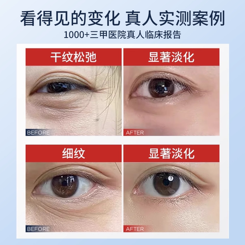 吕良伟代言帅楠大眼袋贴抗皱紧致眼纹鱼尾纹男女士眼贴膜官方正品 - 图1
