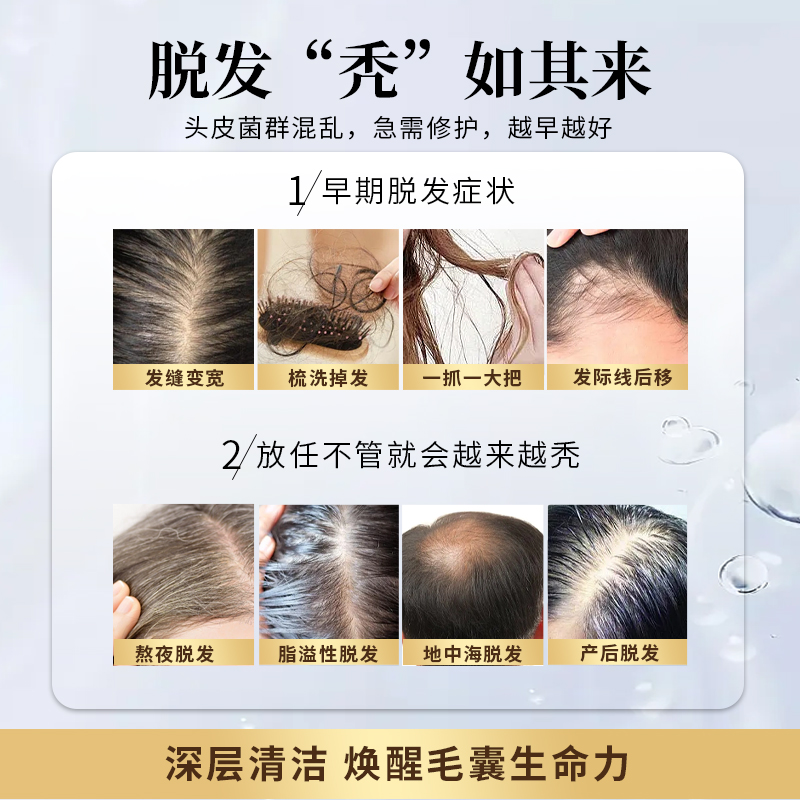 Newmo日本防脱发固发洗发水生控油发蓬松无硅油正品官方旗舰店