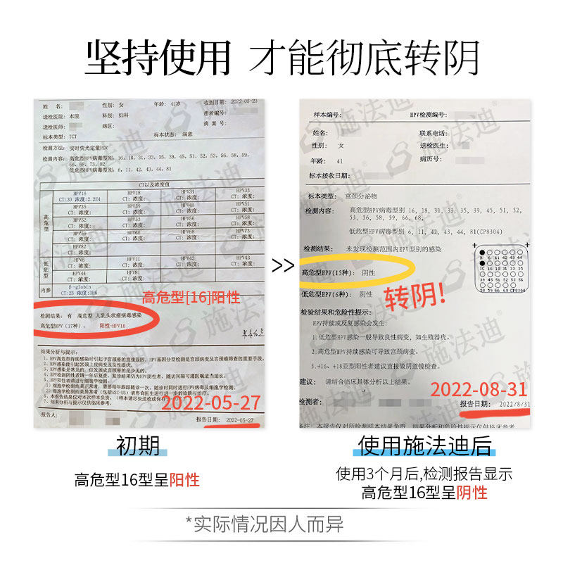 施法迪抗菌型私处护理抑菌杀菌凝胶 施法迪私处洗液