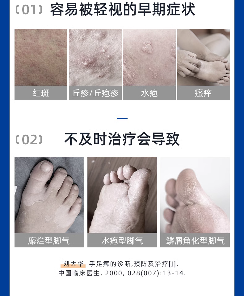 999皮炎平三九曲安奈德益康唑乳膏20g皮炎软膏皮炎细菌感染药AY