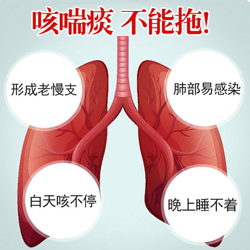 支气管炎平喘偏方哮喘灸咳喘贴大人 许善堂膏药贴（器械）