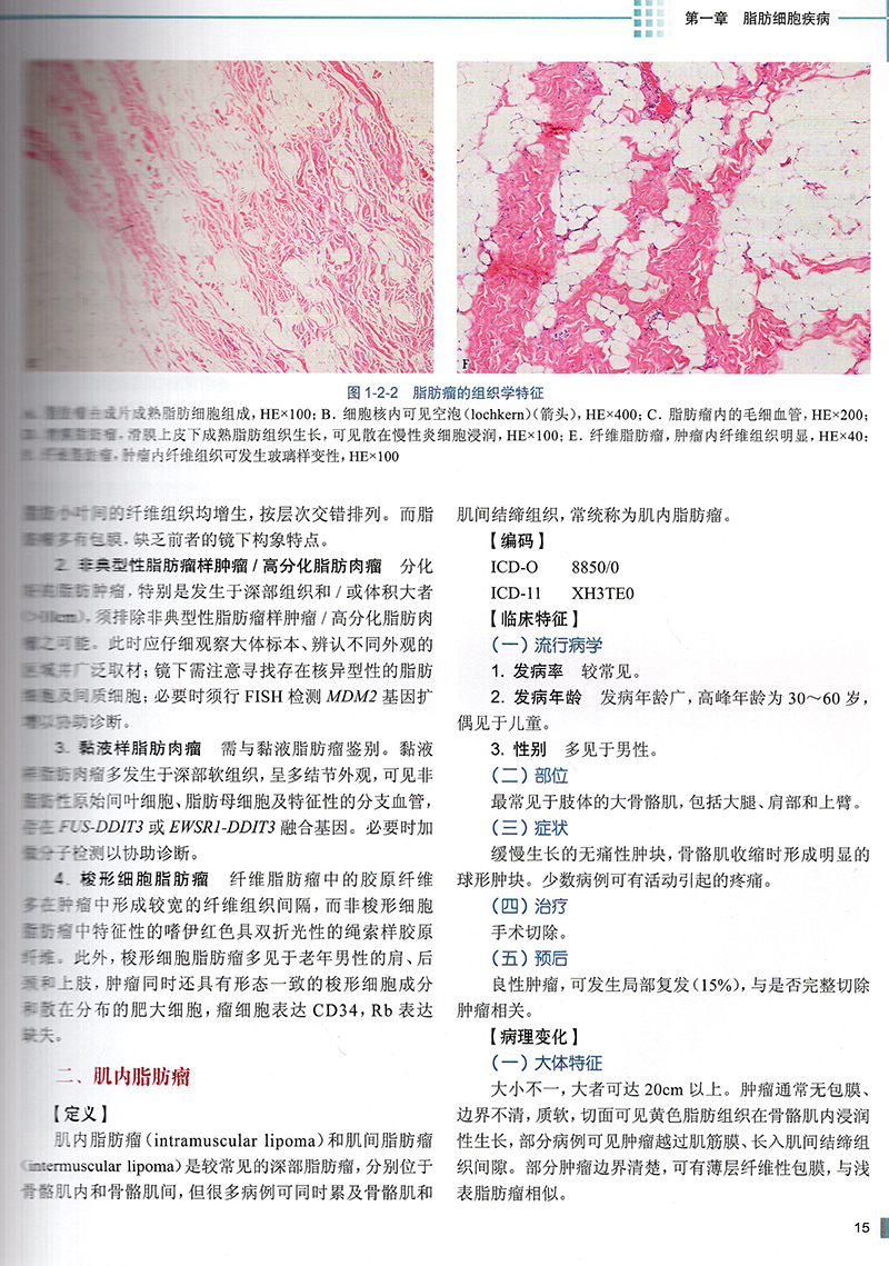 现货临床病理诊断与鉴别诊断软组织疾病国内名院名科知名专家临床病理一书一网络平台丛书附增值人民卫生出版社9787117299398-图4