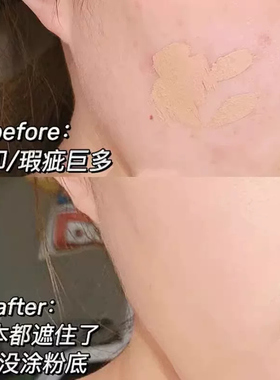 遮瑕膏遮盖斑点痘印脸部官方正品