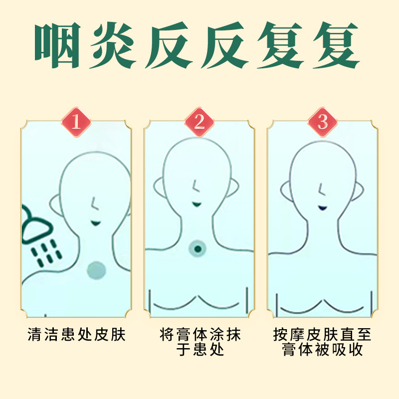 咽炎慢性咽炎 伊绾膏药贴（器械）