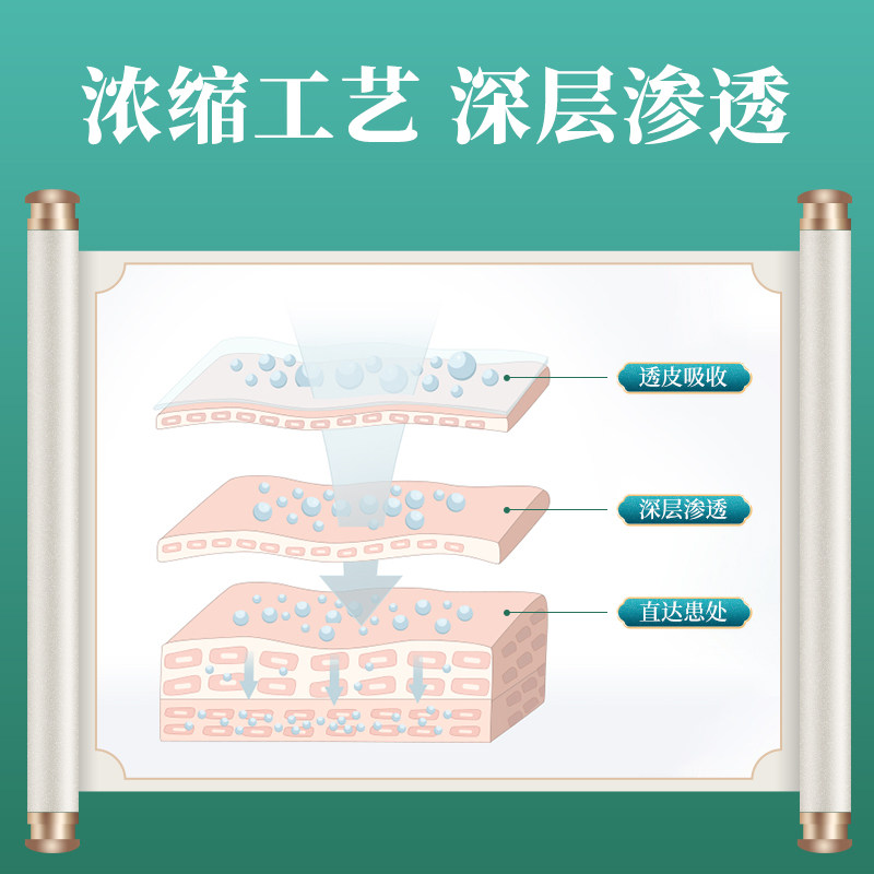 咽炎慢性咽炎 伊绾膏药贴（器械）