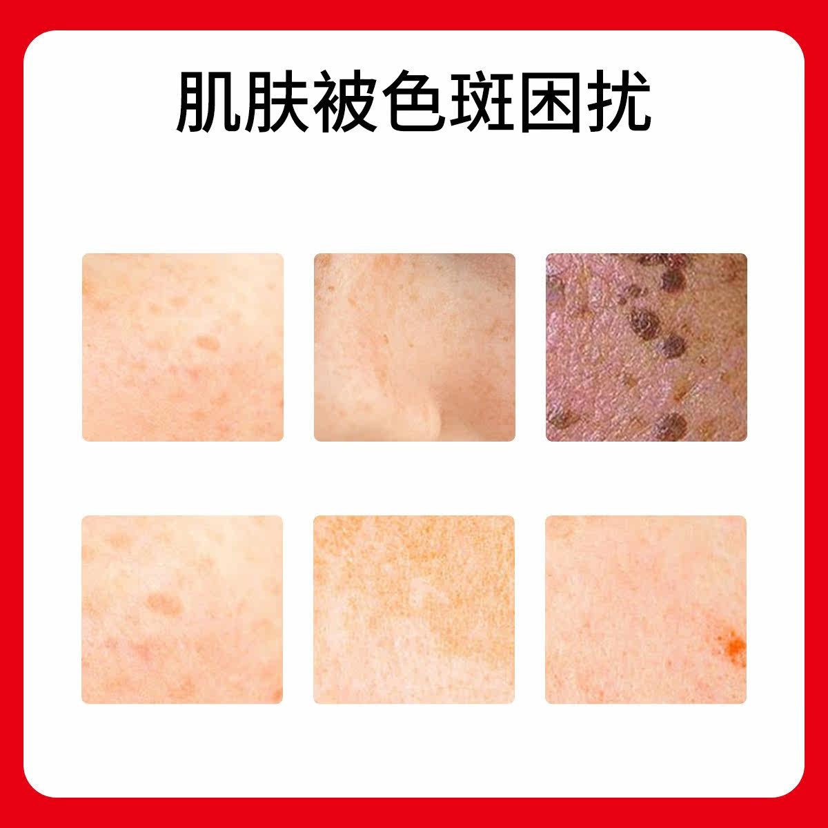 仁和匠心可配祛斑霜烟酰胺祛斑套盒 小半生乳液/面霜