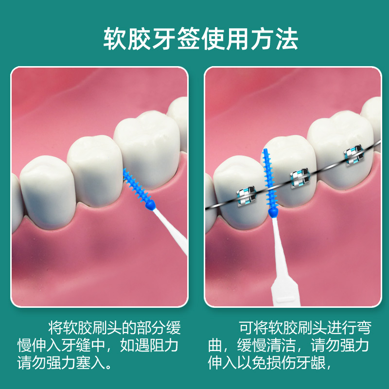 齿点软胶牙缝刷自适应牙缝清洁软胶超细牙签牙间隙刷剔牙神器40支-图2