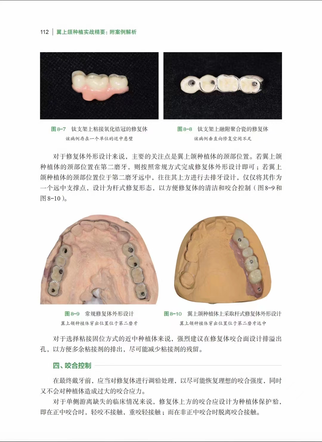 全新正版 翼上颌种植实战精要 附案例解析 舒凌 任杰 主编 上海科学技术出版社 适合口腔种植科医师阅读 上颌磨牙区垂直骨高度不足