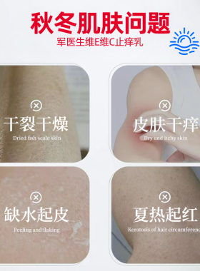 夏季干热痒止痒身体乳