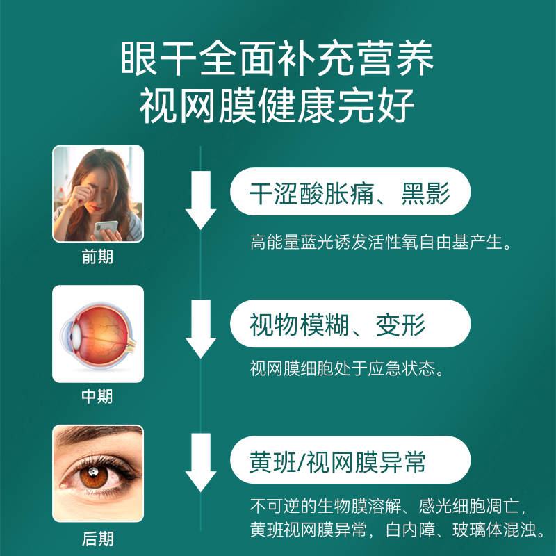 英国眼博士叶黄素胶囊Omega3越橘枸杞成人护眼保健品theeyedoctor - 图2