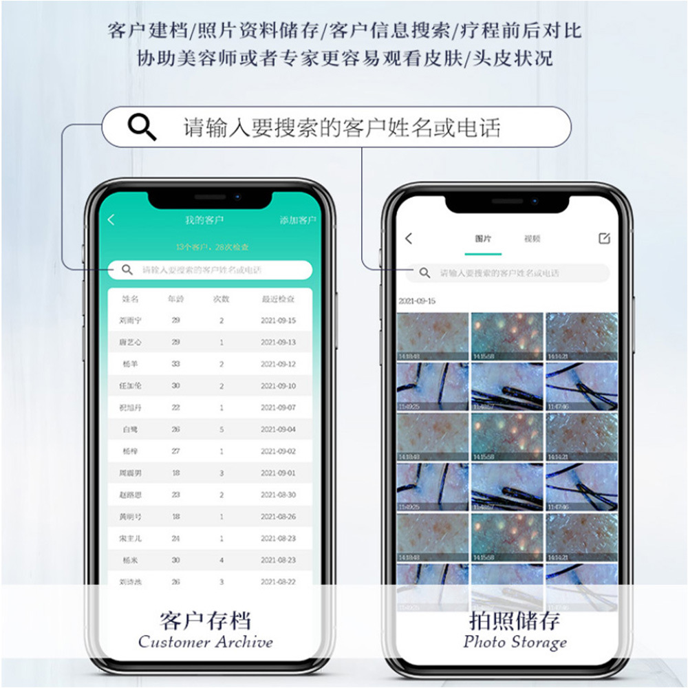 头皮检测仪毛囊头发分析仪皮肤测试仪器高清检测仪无线连接-图2