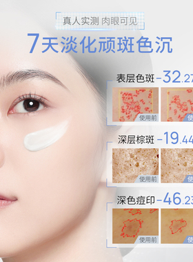 【持证亮白】JC自由之丘净白淡斑膏30g焕白淡斑亮肤