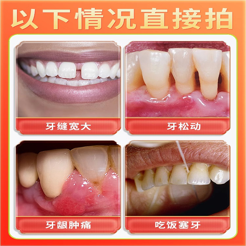 牙缝宽大修复神器硅牙膏正品填充门牙牙缝大牙松动固齿专用牙膏 - 图1