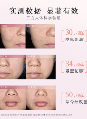 【10粒装】枫缇面中丰盈精华油胶囊脸部抗皱润肤修护法令纹苹果肌