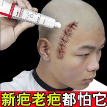 Scar-removing scar-free scar) for men and women to scar the scar old scar old scar stitches Scark one erase medical