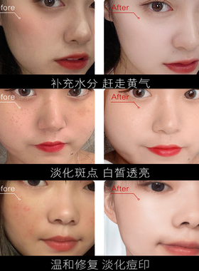 仁和匠心面膜补水保湿美白淡斑紧致男女通用淡化痘印祛痘收缩毛孔