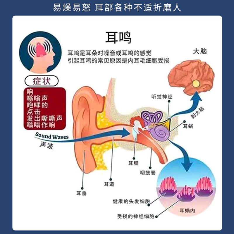 耳鸣膏神经性耳聋专用耳朵嗡嗡响神经性耳鸣王克星听力下降膏药贴 - 图2