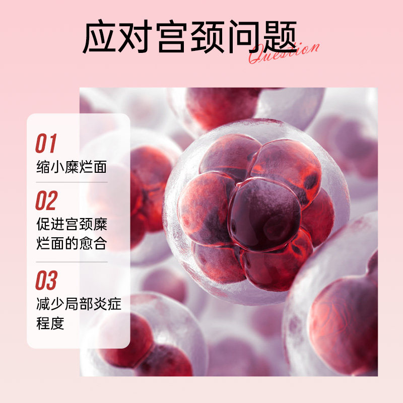  妇炎洁贝蒂尔私处护理（器械）