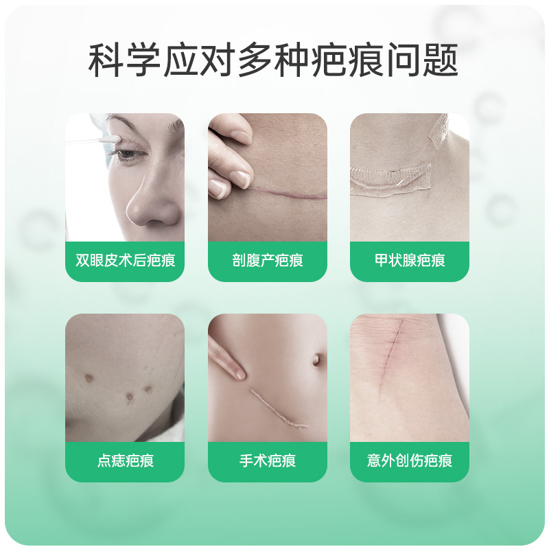豌豆医疗 1号管 医用硅酮疤痕凝胶 预防改善疤痕 去疤祛疤膏