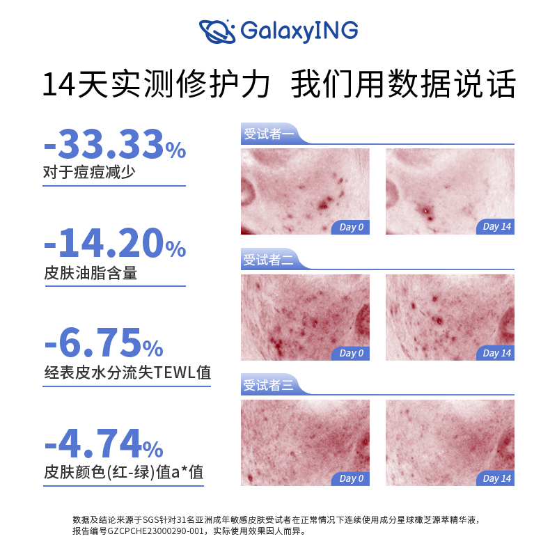 GalaxyING/成分星球【天猫U先】橄芝舒缓修护面部精华油橄榄祛痘-图0