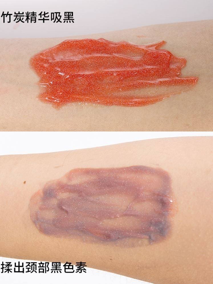 脖子美白啫喱全身去除黑色素颈霜 FTFR颈霜