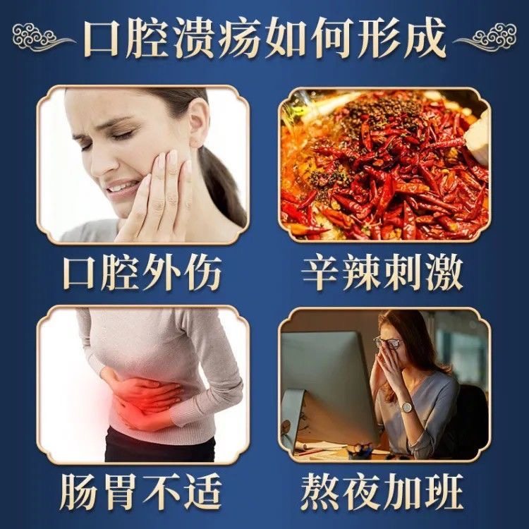 口腔溃疡喷剂儿童成人 利军医疗器械保健理疗