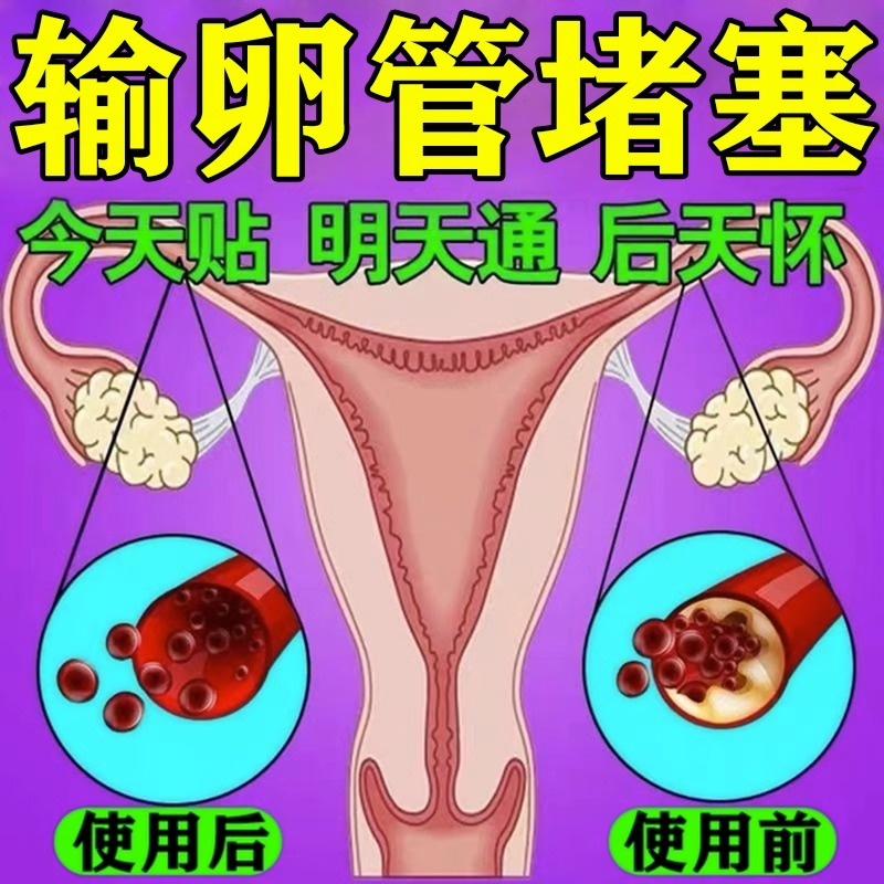 促孕调理贴双胞胎龙凤胎助孕神器促排卵多囊调经暖宫女士备孕贴QR-图2