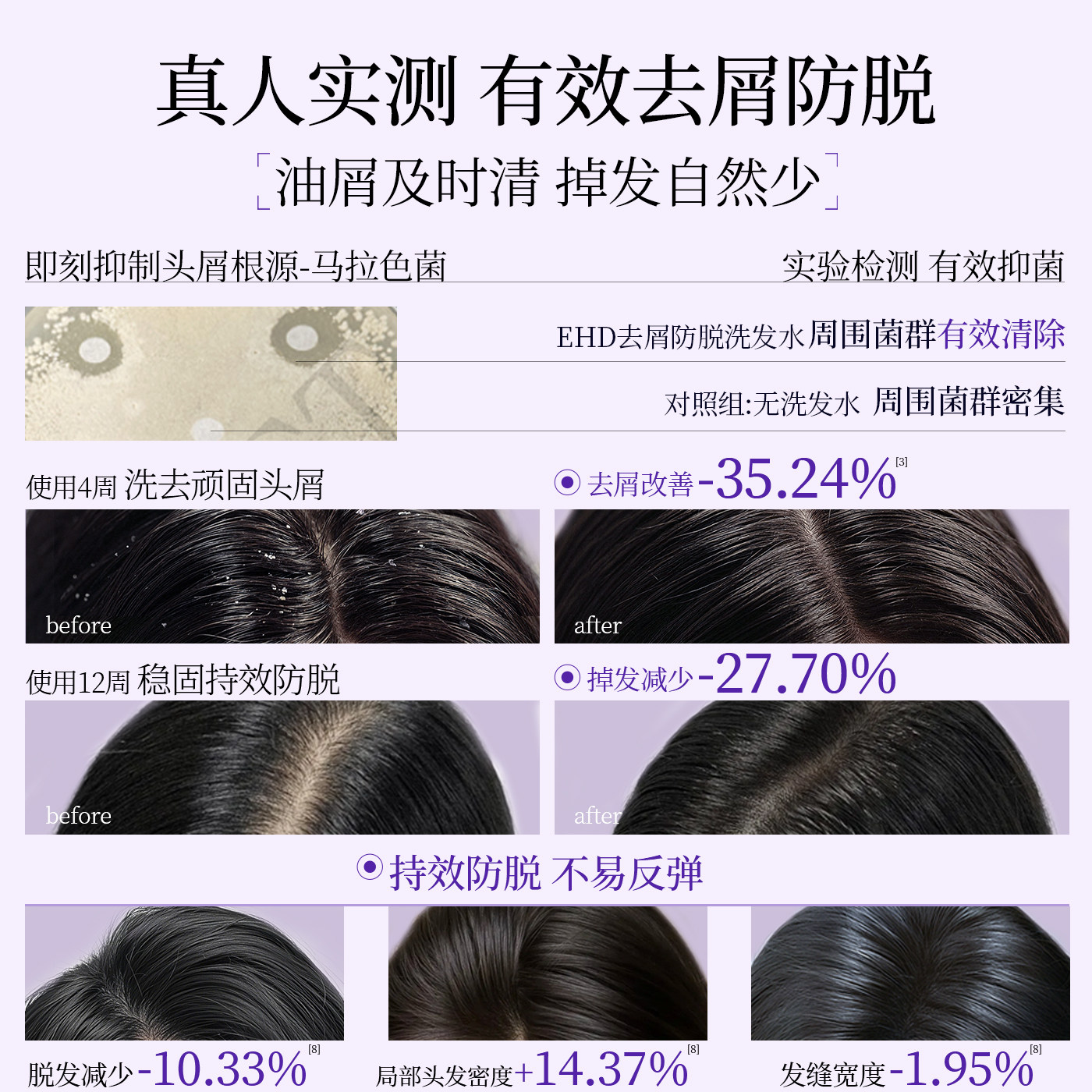 EHD防脱洗发水控油蓬松去屑固发防断何首乌侧柏叶男女洗头膏露