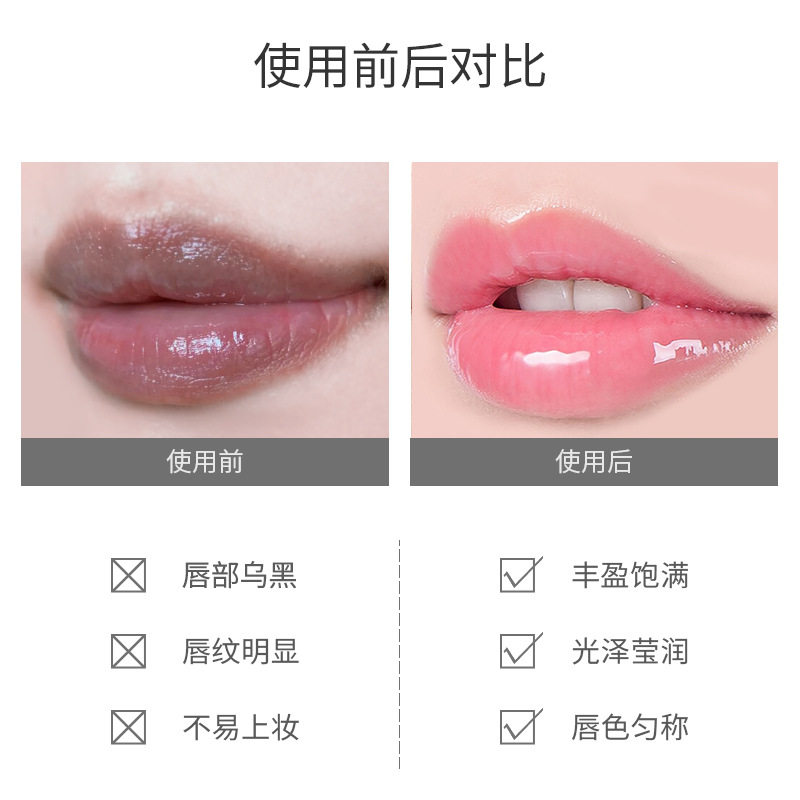 断黑唇部啫喱精华drzi嘴角女润唇膏 町妮润唇膏