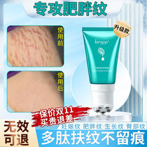 Growth Ripples Elimination Thighs Students Obese Tattox Removal Butt men and women Prevention Desalinated Pregnancy Postpartum Tattox Repair Cream