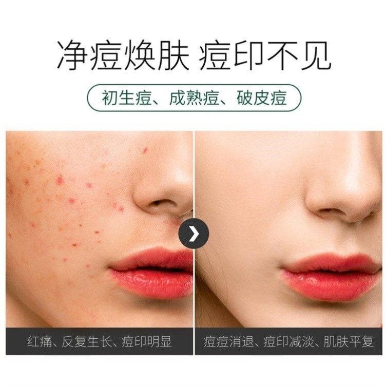 t7芦荟胶祛痘保湿晒后修复膏男凝胶 mcdiaoc乳液/面霜