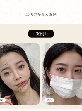 睦色纹绣打雾神针二侠三侠针排针
