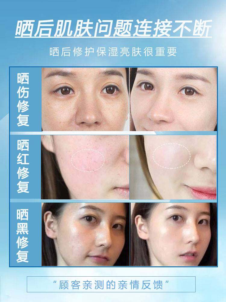 晒后修复深层补水提亮肤色修护冰膜 DeaoMax贴片面膜